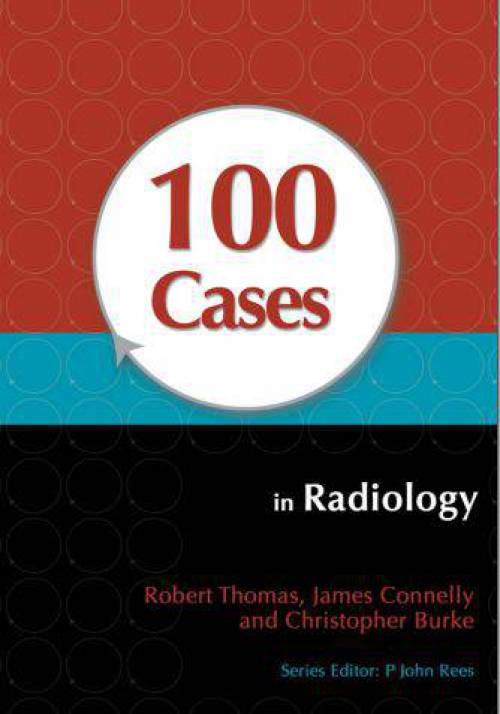 دانلود کتاب بررسی صد مورد رادیولوژی